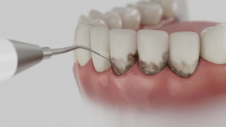 Reliable Dental contractor in Merkel, TX by Smile Center Dentistry